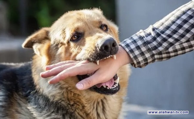 الصحة: لقاح داء الكلب متوفر والوقاية منه ممكنة خلال الساعات الأولى فقط