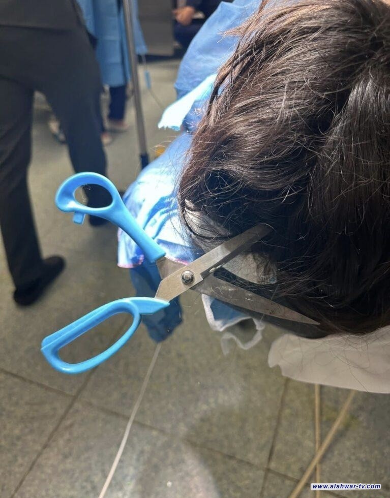 إنقاذ طفلة بعد طعنها بآلة حادة اخترقت جمجمتها في الناصرية