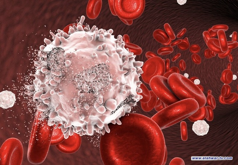 اكتشاف الحلقة المفقودة بين التهاب النخاع المزمن وأورام الدم
