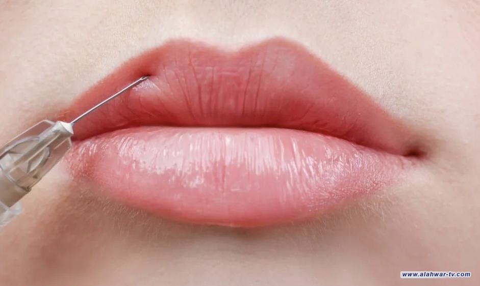 بالوثيقة.. الصحة تمنع أطباء الاسنان من استخدام حقن "البوتكس و"الفيلر