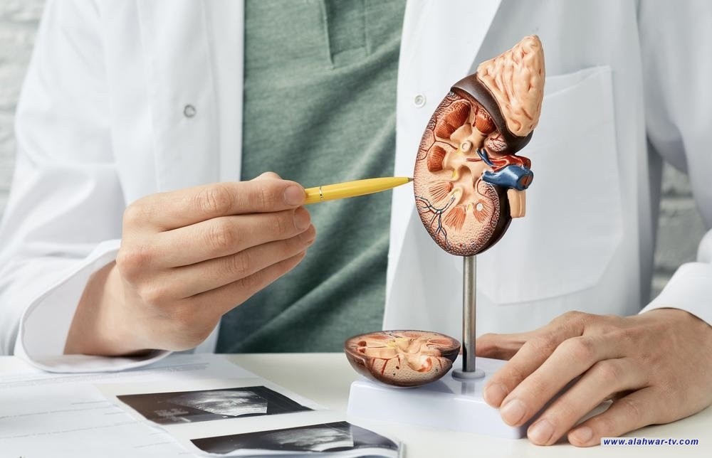 نصائح طبية لمنع تكون حصى الكلى. تجنب السوائل المحتوية على الكافيين