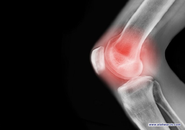 تغيير بسيط في طريقة المشي يخفف ألم الركبة ويؤخر الجراحة لسنوات