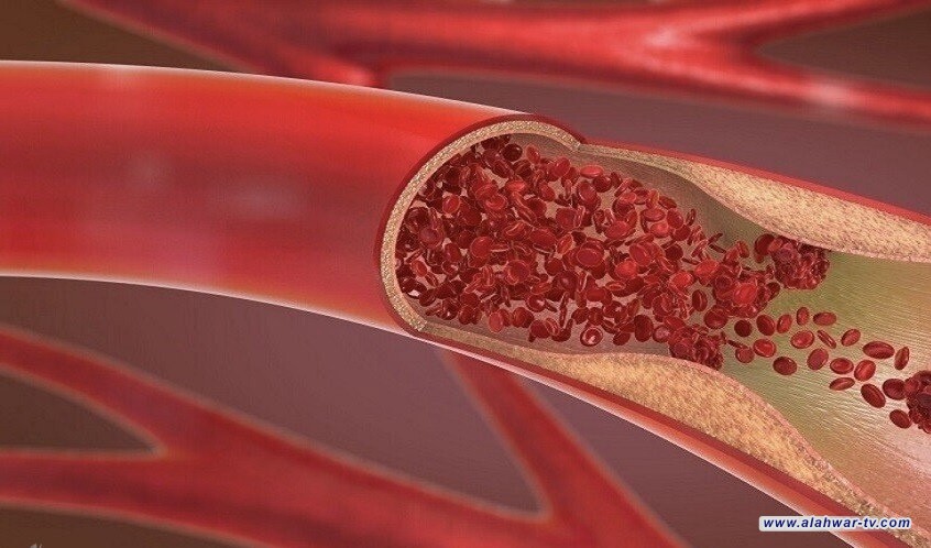 دراسة: الدهون الحشوية تسرع شيخوخة القلب
