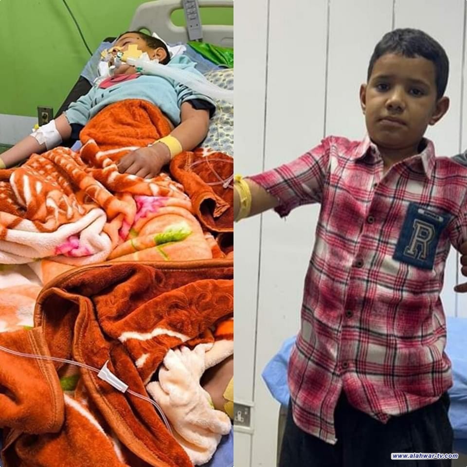 انقاذه حياة طفل تعرض لصعقة كهربائية تسببت بفقدانه الوعي وصرع لمدة 12 ساعة