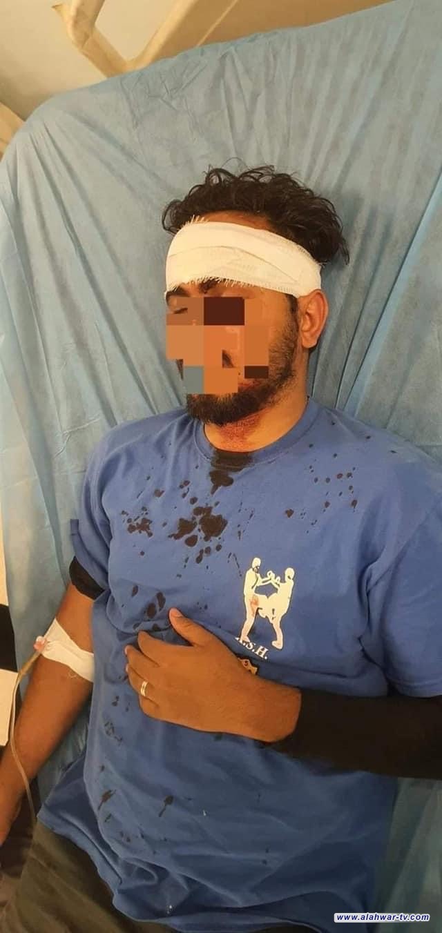 اوساط رسمية وشعبية ترفض الاعتداء على الخريجين المتظاهرين امام شركة توزيع المنتجات النفطية في ذي قار المطالبين بحقوقهم المشروعة في التعيين وتطالب بالتحقيق في هذا الامر