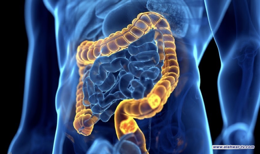 اكتشاف طريقة واعدة لإبطاء سرطان القولون وزيادة فرص النجاة