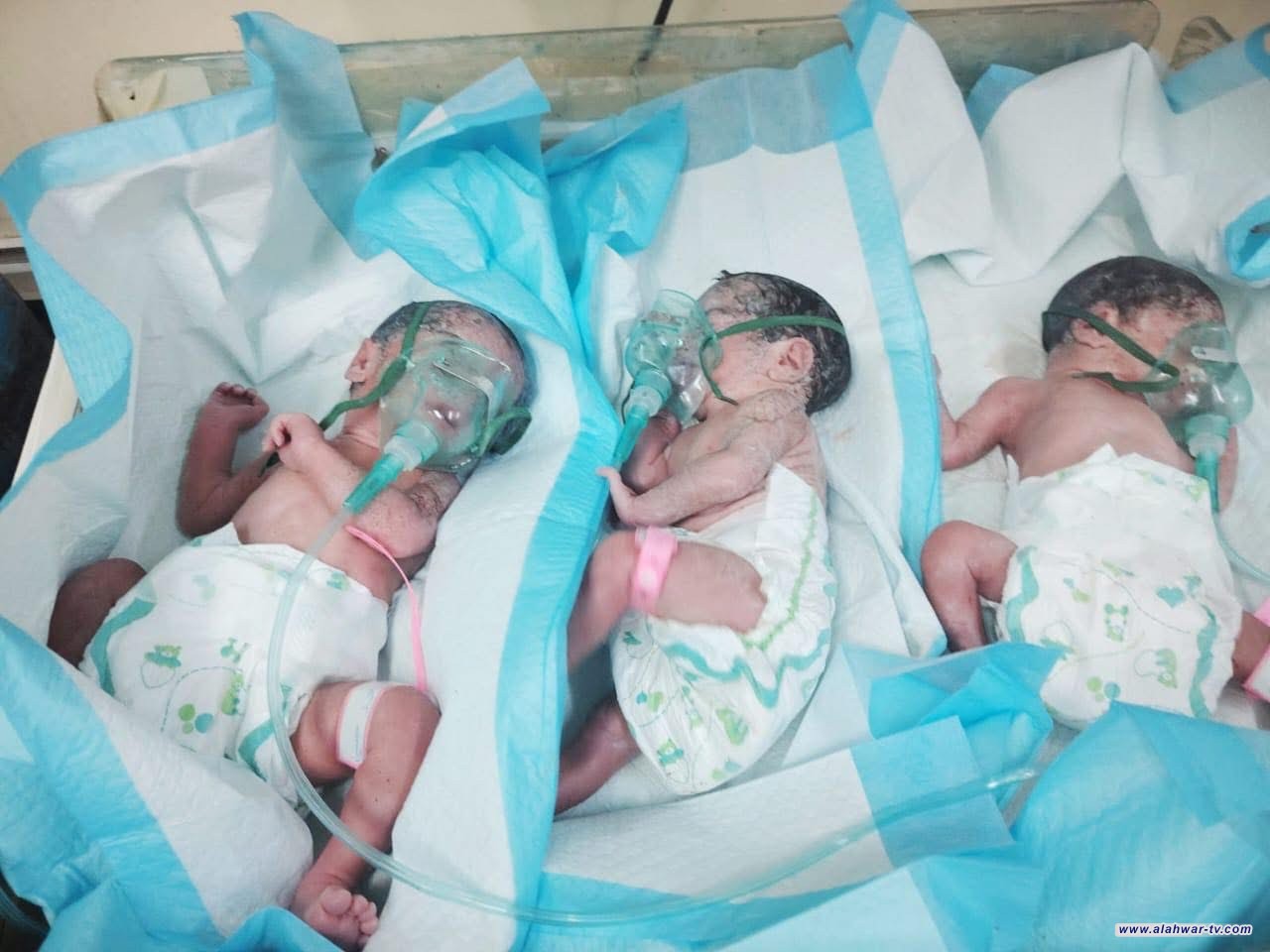 ولادة ثلاثية نادرة في مستشفى بنت الهدى التعليمي بذي قار