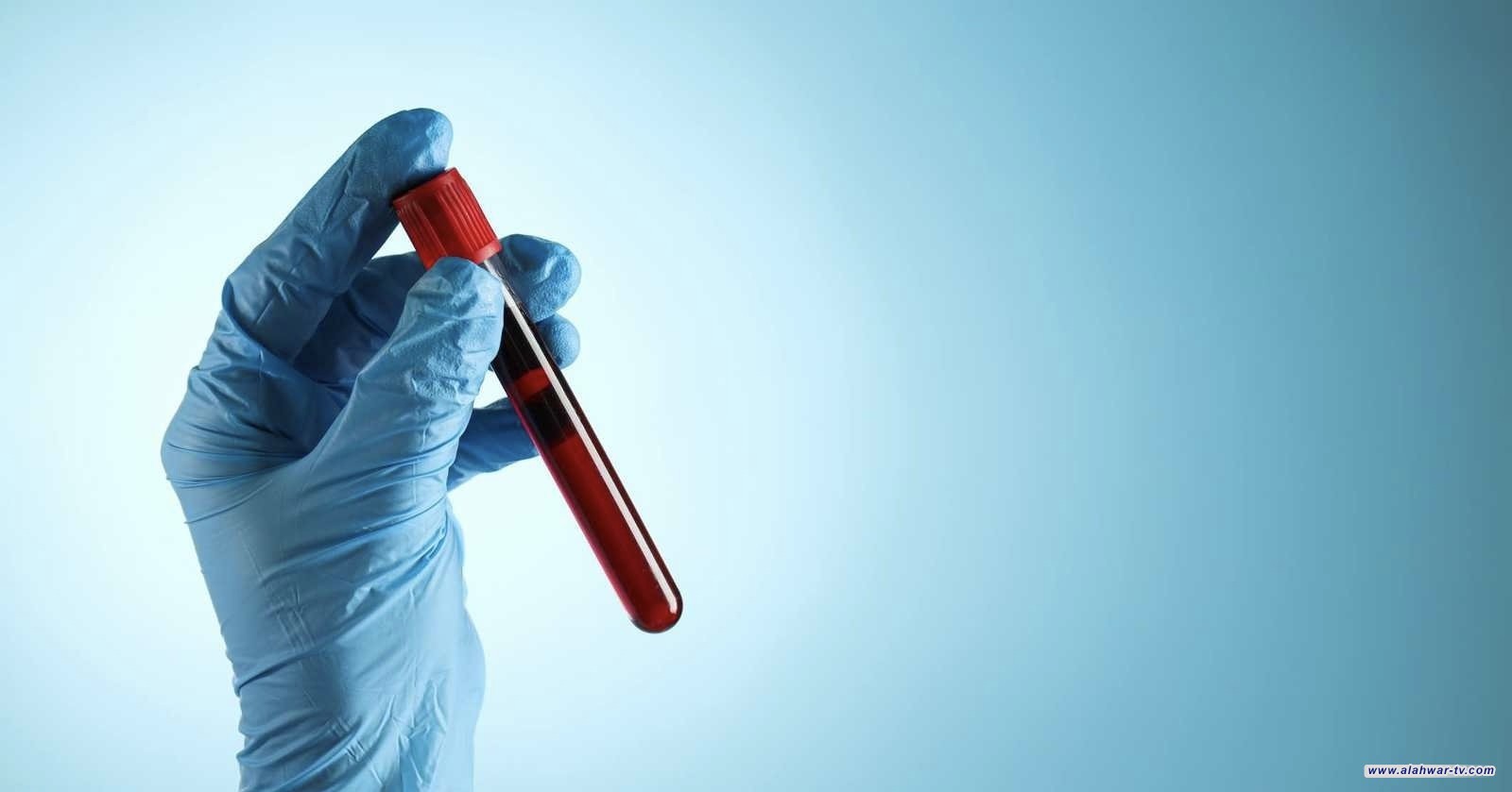 فحص دم بسيط قد يكشف خطر الإصابة بمرض ألزهايمر قبل سنوات من ظهور الأعراض