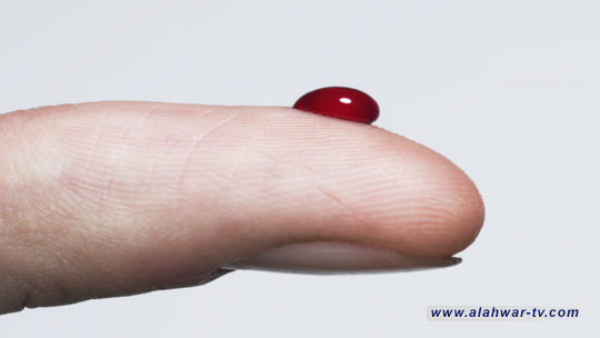 علماء يأملون علاج مرضى السكري بالموسيقى