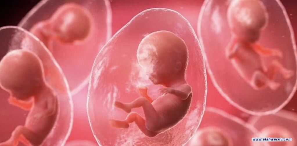 ولادة اول طفل في العالم بتلقيح الذكاء الاصطناعي