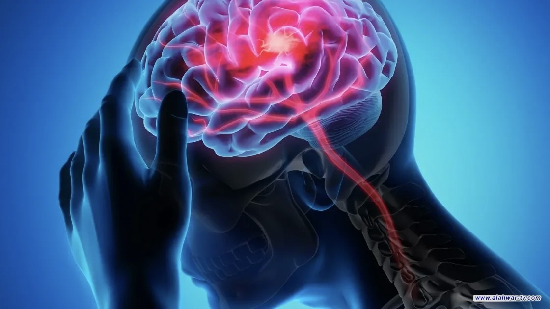 عامل غير تقليدي يرتبط بزيادة خطر السكتة الدماغية المبكرة