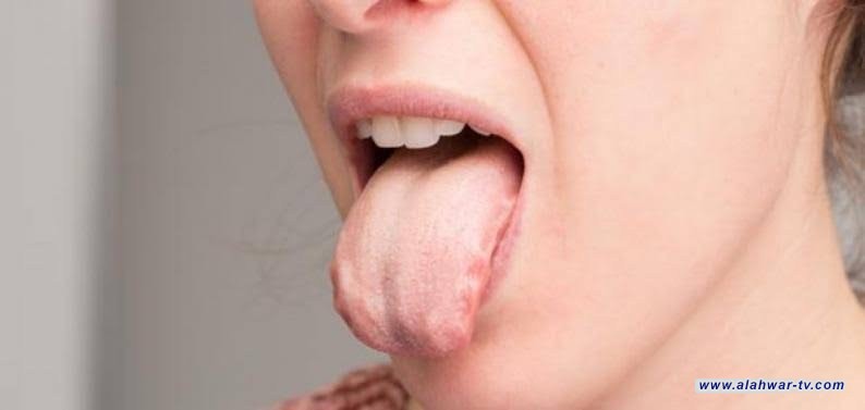 بالذكاء الاصطناعي.. باحثون عراقيون يشخصون الأمراض عن طريق اللسان