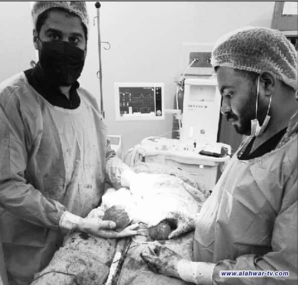 مستشفى الشطرة العام: نجاح عملية رفع  ورم يزن (500 )غرام لمريضة بالعقد الرابع من العمر